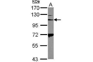 WB Image Sample (30 ug of whole cell lysate) A: K562 7. (Integrin Alpha2b antibody  (C-Term))
