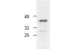 Image no. 1 for anti-Caspase 4, Apoptosis-Related Cysteine Peptidase (CASP4) antibody (ABIN126973) (Caspase 4 antibody)
