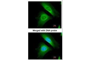 ICC/IF Image Immunofluorescence analysis of paraformaldehyde-fixed HeLa, using Optineurin, antibody at 1:200 dilution. (OPTN antibody)