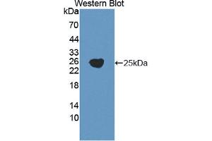 Figure. (GGT5 antibody  (AA 388-586))