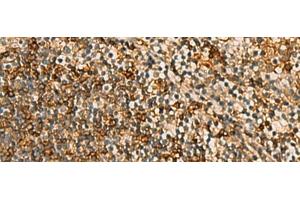 Immunohistochemistry of paraffin-embedded Human tonsil tissue using HORMAD2 Polyclonal Antibody at dilution of 1:45(x200) (HORMAD2 antibody)