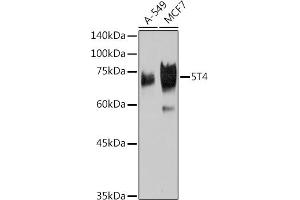 Western blot analysis of extracts of various cell lines, using 5T4 Rabbit mAb (ABIN7271009) at 1:1000 dilution. (TPBG antibody)
