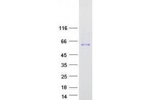 Validation with Western Blot (TTC39C Protein (Transcript Variant 2) (Myc-DYKDDDDK Tag))