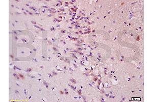 Formalin-fixed and paraffin embedded: rat brain tissue labeled with Anti-Tau protein Polyclonal Antibody (ABIN725600), Unconjugated at 1:200 followed by conjugation to the secondary antibody and DAB staining (tau antibody  (AA 681-758))