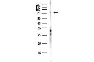 anti-Zinc Finger Protein 233 (ZNF233) antibody