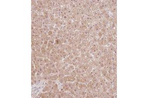 Immunohistochemistry (Paraffin-embedded Sections) (IHC (p)) image for anti-Ribosomal Protein S18 (RPS18) (AA 62-91) antibody (ABIN390874)