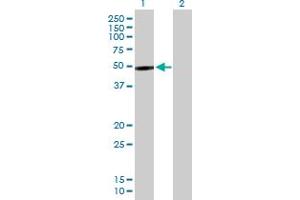 Western Blot analysis of PIP4K2B expression in transfected 293T cell line by PIP4K2B MaxPab polyclonal antibody. (PIP4K2B antibody  (AA 1-416))