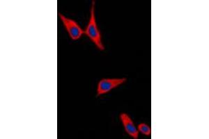 Immunofluorescent analysis of E Cadherin staining in PC12 cells. (E-cadherin antibody  (C-Term))