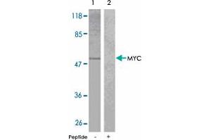 Western blot analysis of extracts from NIH/3T3 cells treated with EGF using MYC polyclonal antibody . (c-MYC antibody)