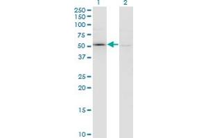 Western Blot analysis of F11 expression in transfected 293T cell line by F11 monoclonal antibody (M01), clone 2H8. (Factor XI antibody  (AA 286-385))