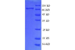 SDS-PAGE (SDS) image for Ribophorin 1 (RPN1) (AA 44-427), (partial) protein (GST tag) (ABIN4976535)