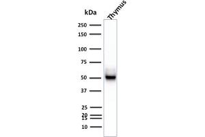 Western Blot Analysis of Human Thymus tissue lysate using Cytokeratin 15 Mouse Monoclonal Antibody (KRT15/2957) (KRT15 antibody)