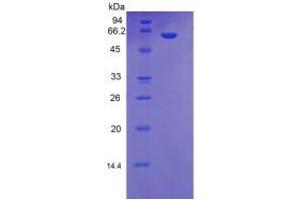 SDS-PAGE analysis of Human MBL2 Protein. (MBL2 Protein)