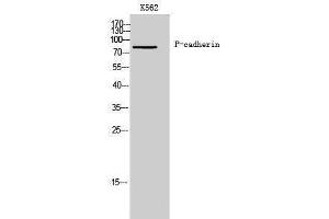 Western Blotting (WB) image for anti-P-Cadherin (CDH3) (N-Term) antibody (ABIN3180797) (P-Cadherin antibody  (N-Term))