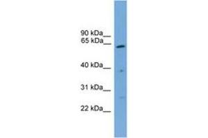 Image no. 1 for anti-Proteasome (Prosome, Macropain) 26S Subunit, Non-ATPase, 3 (PSMD3) (C-Term) antibody (ABIN6745117) (PSMD3 antibody  (C-Term))