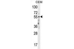 5HT3E Antibody (HTR3E antibody  (Middle Region))