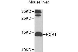 Western blot analysis of extracts of mouse liver cells, using HCRT antibody. (Orexin antibody)