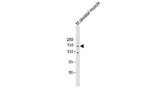 All lanes : Anti-ITGA11 Antibody (N-term) at 1:500 dilution Lane 1: Mouse skeletal muscle lysate Lysates/proteins at 20 μg per lane. (ITGA11 antibody  (N-Term))