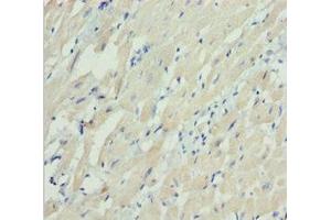 Immunohistochemistry of paraffin-embedded human heart tissue using ABIN7160533 at dilution of 1:100 (MYL3/CMLC1 antibody  (AA 1-195))