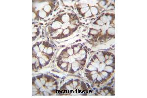 LAD1 Antibody (N-term) (ABIN656787 and ABIN2846006) immunohistochemistry analysis in formalin fixed and paraffin embedded human rectum tissue followed by peroxidase conjugation of the secondary antibody and DAB staining.