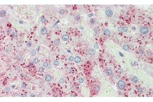 Detection of ORM2 in Human Liver Tissue using Polyclonal Antibody to Orosomucoid 2 (ORM2) (Orosomucoid 2 antibody  (AA 19-207))