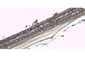 Immunohistochemistry (IHC) image for anti-Arrestin 3, Retinal (X-Arrestin) (ARR3) (C-Term) antibody (ABIN570667)