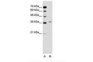 Image no. 1 for anti-Aminolevulinate Dehydratase (ALAD) (AA 91-140) antibody (ABIN6736618) (ALAD antibody  (AA 91-140))