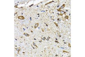 Immunohistochemistry of paraffin-embedded mouse spinal cord using SLC23A2 antibody (ABIN5974077) at dilution of 1/100 (40x lens). (SLC23A2 antibody)