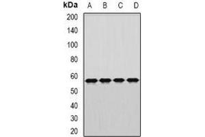 Western blot analysis of DARS expression in MCF7 (A), SW480 (B), mouse brain (C), rat liver (D) whole cell lysates.