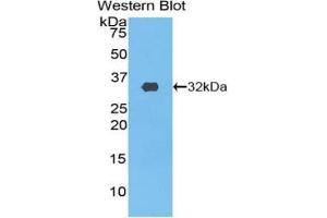 Detection of Recombinant PIK3C2b, Rat using Polyclonal Antibody to Phosphoinositide-3-Kinase Class-2-Beta Polypeptide (PIK3C2b) (PIK3C2B antibody  (AA 790-1025))