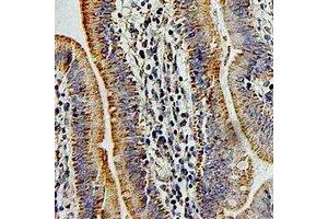 Immunohistochemistry (IHC) image for anti-Pregnancy Specific beta-1-Glycoprotein 1 (PSG1) antibody (ABIN7308238) (PSG1 antibody)