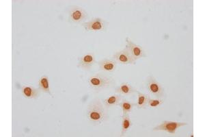 Immunocytochemistry analysis of forHU diluted at 1:20 and staining in Hela cells(treated with 30 mM sodium butyrate for 4h) performed on a Leica BondTM system. (Histone H1.3 antibody  (AA 137-149))