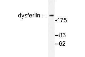 Image no. 1 for anti-Dysferlin (DYSF) antibody (ABIN265388) (Dysferlin antibody)