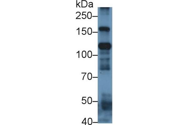 ITIH4 anticorps  (AA 273-424)