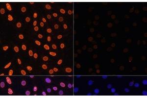 Immunofluorescence analysis of C6 cells using Acetyl-Histone H3-K36 Polyclonal Antibody at dilution of 1:100. (Histone 3 antibody  (acLys36))