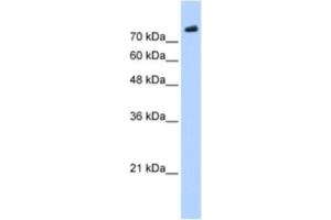 Western Blotting (WB) image for anti-PHD Finger Protein 20 (PHF20) antibody (ABIN2461244) (PHF20 antibody)