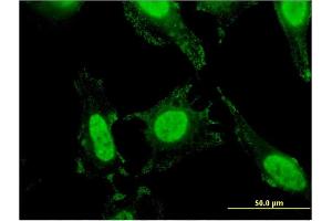 Immunofluorescence of monoclonal antibody to SLC4A1 on HeLa cell. (Band 3/AE1 antibody  (AA 261-360))