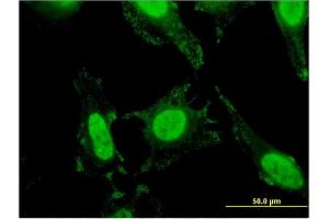 Immunofluorescence of monoclonal antibody to SLC4A1 on HeLa cell. (Band 3/AE1 antibody  (AA 261-360))