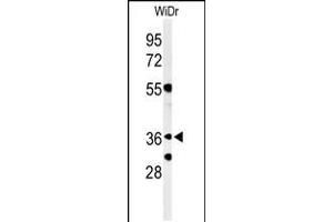 Western blot analysis of NSE4A Antibody in WiDr cell line lysates (35ug/lane) (NSMCE4A antibody  (N-Term))