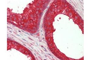Human Prostate: Formalin-Fixed, Paraffin-Embedded (FFPE) (NEDD4-2 antibody  (AA 275-325))