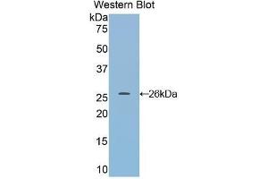 Western Blotting (WB) image for anti-Dimethylarginine Dimethylaminohydrolase 1 (DDAH1) (AA 20-215) antibody (ABIN1858614) (DDAH1 antibody  (AA 20-215))