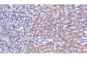 Immunohistochemistry (IHC) image for anti-Hypoxia Inducible Factor 1, alpha Subunit (Basic Helix-Loop-Helix Transcription Factor) (HIF1A) (AA 575-826) antibody (ABIN7432634)