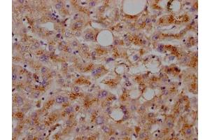 Immunohistochemistry (IHC) image for anti-Low Density Lipoprotein Receptor (LDLR) antibody (ABIN7127599)