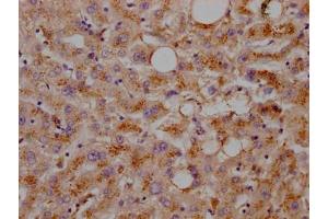 IHC image of ABIN7127599 diluted at 1:100 and staining in paraffin-embedded human liver tissue performed on a Leica BondTM system.