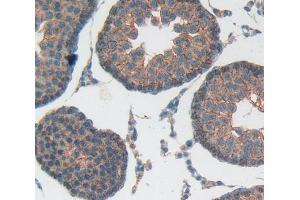 IHC-P analysis of Kidney tissue, with DAB staining. (NOX5 antibody  (AA 456-765))