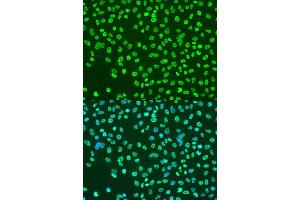 Immunofluorescence analysis of U2OS cells using Acetyl-Histone H3-K9 antibody (ABIN4903918) at dilution of 1:100. (Histone 3 antibody  (H3K9ac))