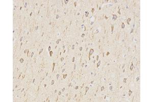 Immunohistochemistry analysis of paraffin-embedded rat brain using LC3A/B Polyclonal Antibody at dilution of 1:500. (LC3A / LC3B antibody)