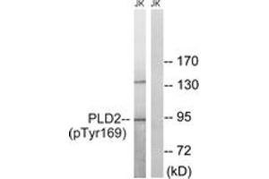 Western blot analysis of extracts from Jurkat cells treated with TNF 20ng/ml 30', using PLD2 (Phospho-Tyr169) Antibody. (Phospholipase D2 antibody  (pTyr169))