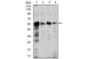 Image no. 4 for anti-Calcium/calmodulin-Dependent Protein Kinase IV (CAMK4) antibody (ABIN1491438) (CAMK4 antibody)