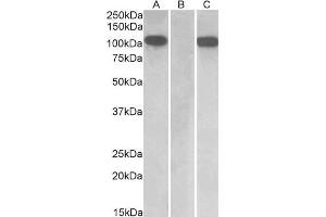 HEK293 lysate (10 µg protein in RIPA buffer) overexpressing Human Furin with C-terminal MYC tag probed with ABIN1590028 (1 µg/mL) in Lane A and probed with anti-MYC Tag (1/1000) in lane C. (FURIN antibody  (Internal Region))